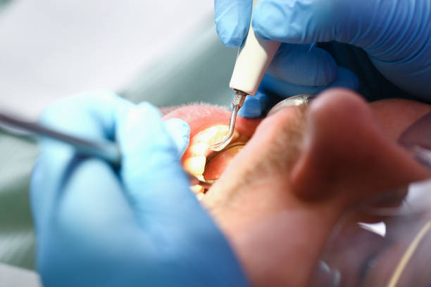 Best Emergency Gum Pain Relief  in Logansport, IN
